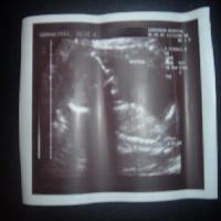 Ultrasound Baby!
11-10-06
  IT'S A GIRL!